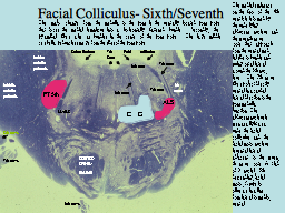 Facial Colliculus- Sixth/Seventh
