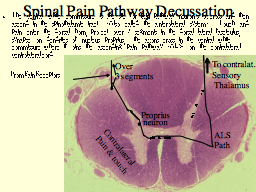 Spinal Pain Pathway Decussation