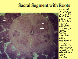 Sacral Segment with Roots