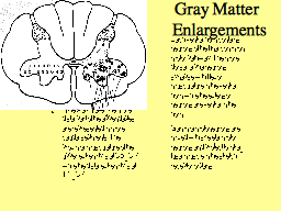 Gray Matter  Enlargements